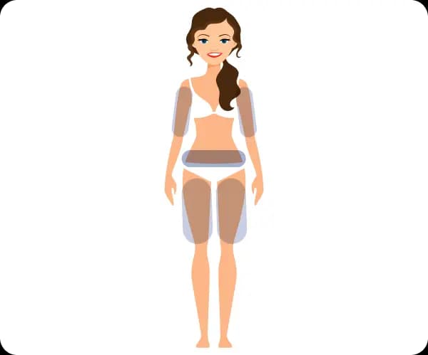 Ilustração dos locais de aplicação